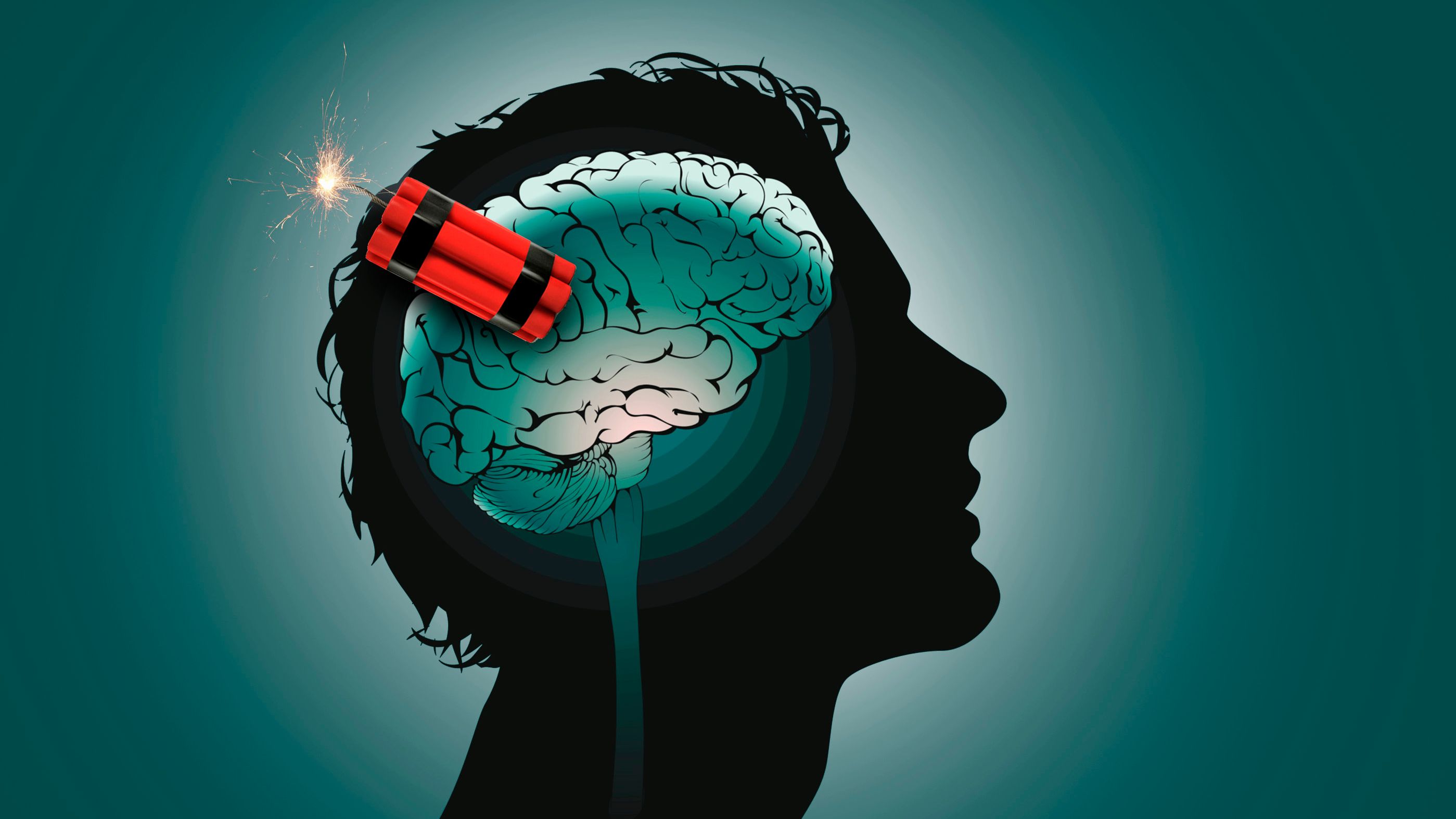 经颅直流电刺激与急性卒中患者的物理治疗相关的一项随机，三盲，假对照研究